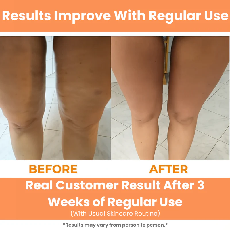 Virvely™ Deep Tissue Massage Roller